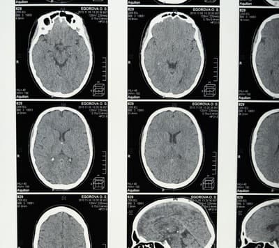 Neurology & Migraine Specialist
