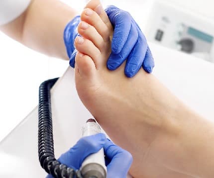 Podokinesologist (insoles)