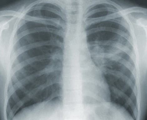 Radiology