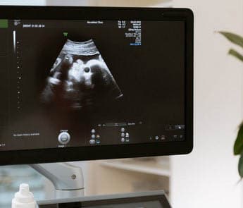 4D Ultrasound