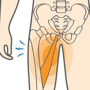 Groin & Scrotum