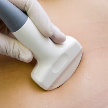 Pelvic Ultrasound Imaging